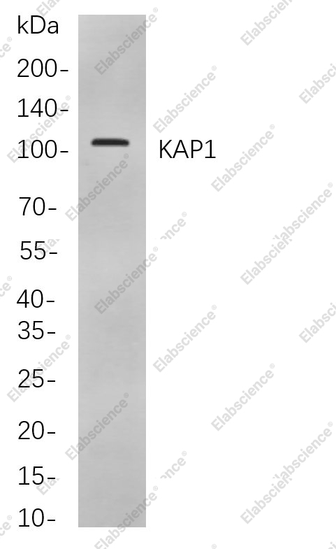 Recombinant KAP1 Monoclonal Antibody - 1