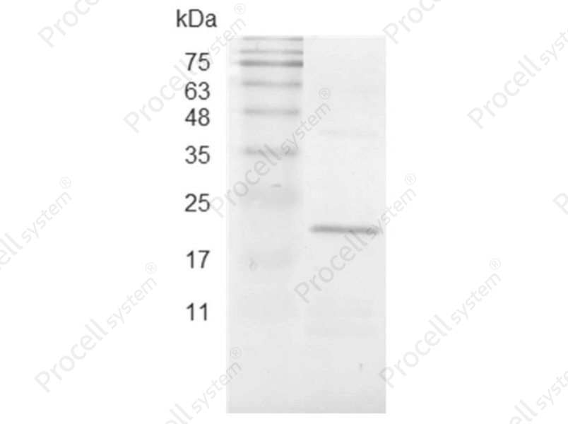 CCL2/MCP-1, Swine, Recombinant