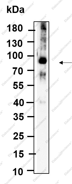 Recombinant ALDH16A1 Monoclonal Antibody - 1