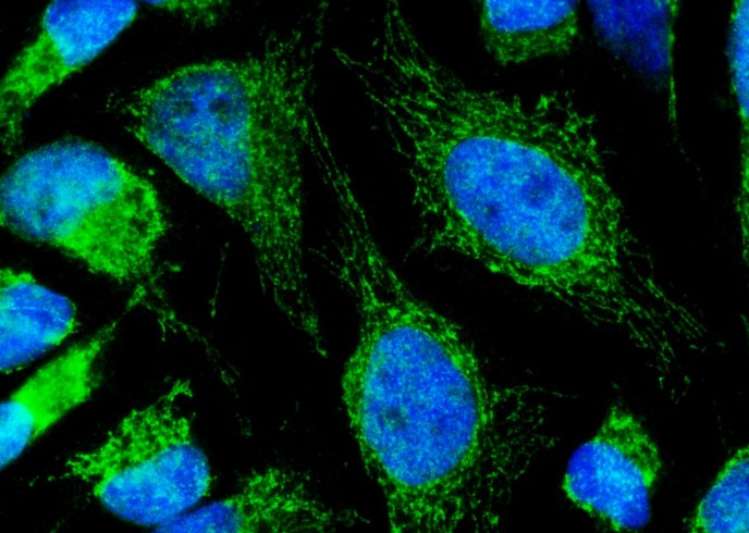 Recombinant Lumican/LUM Monoclonal Antibody-searchlist-1