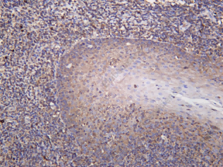 Recombinant CYLD Monoclonal Antibody - 1