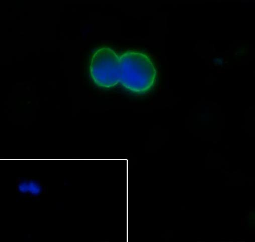 Recombinant GST3/GSTP1 Monoclonal Antibody - small - 5