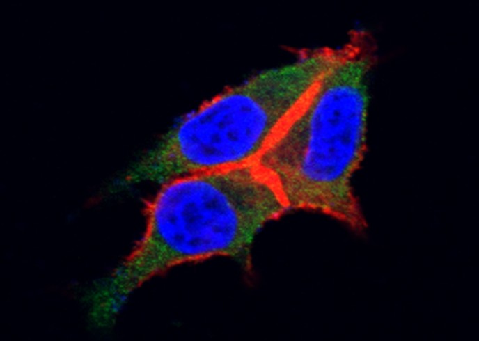 G-CSFR/CD114/CSF3R Monoclonal Antibody-searchlist-1