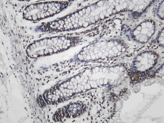 Recombinant EWS Monoclonal Antibody - 1