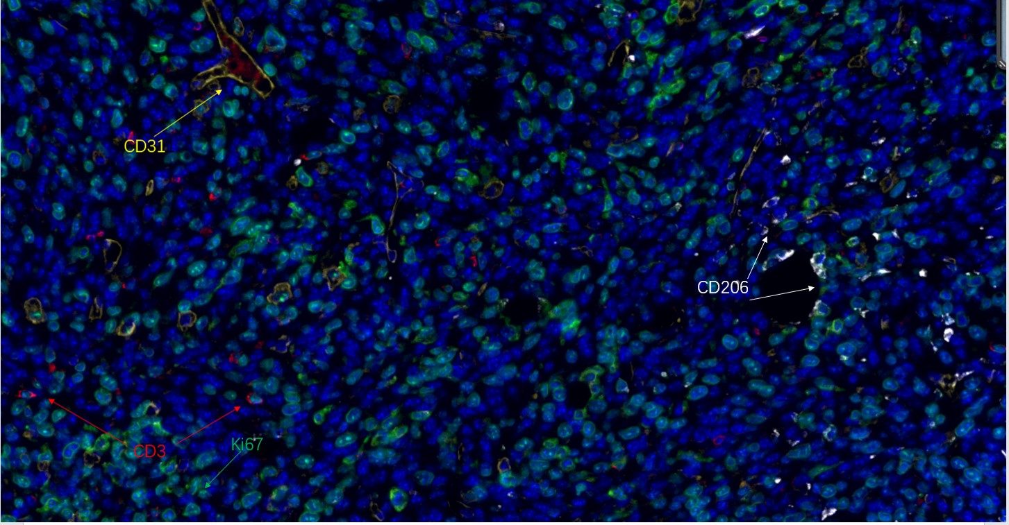 Recombinant CD206/MRC1 Monoclonal Antibody - small - 5