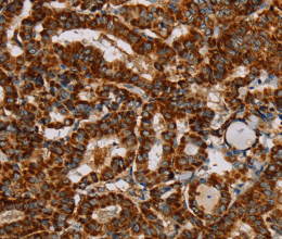 NDUFS3 Polyclonal Antibody - 2