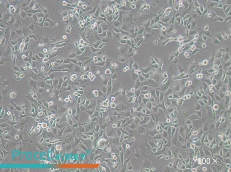 Anglne Cell Complete Medium - 3