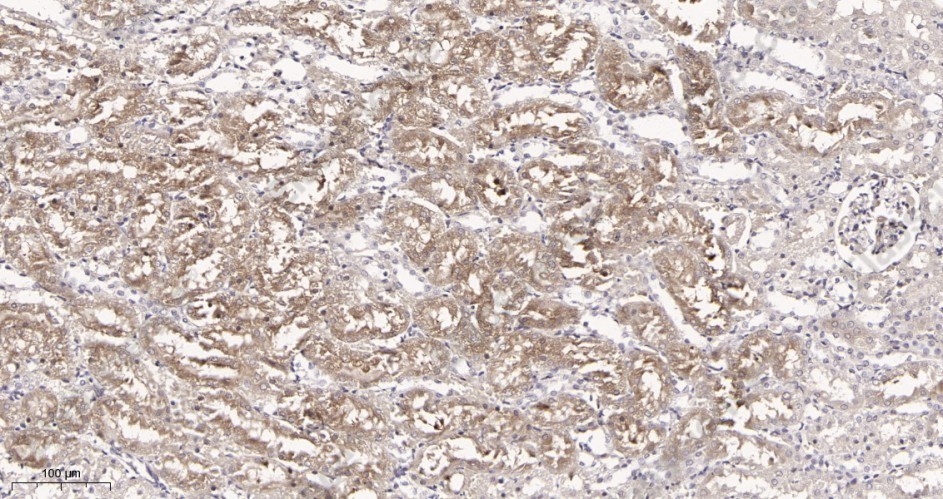 Recombinant RIP Monoclonal Antibody - 2