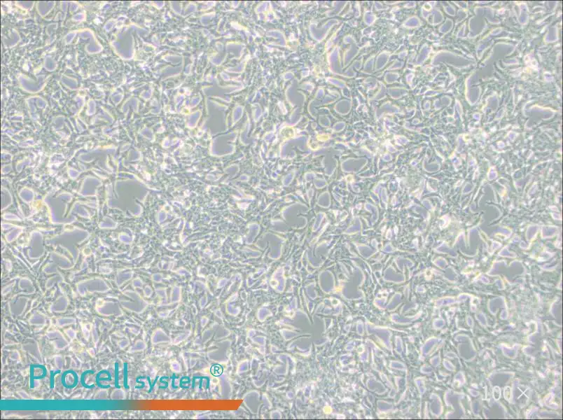 LNCaP clone FGC Cell Complete Medium - 1