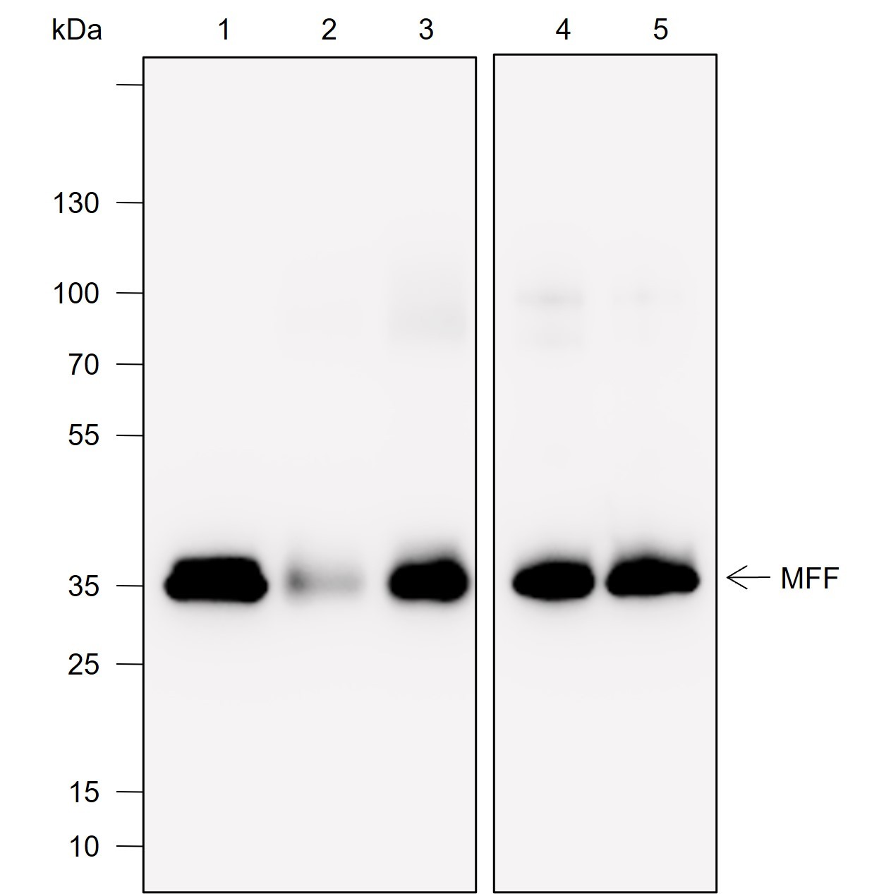 Recombinant MFF Monoclonal Antibody-searchlist-1