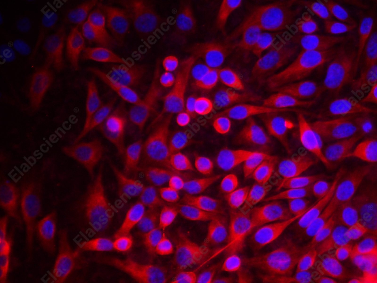 beta Tubulin Monoclonal Antibody - 3