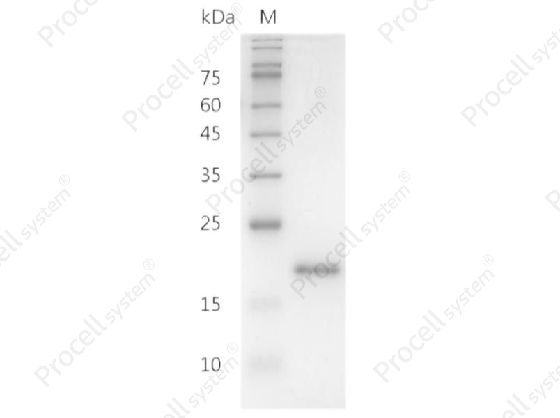 IL-10/B-TCGF/CSIF/TGIF, Human, Recombinant