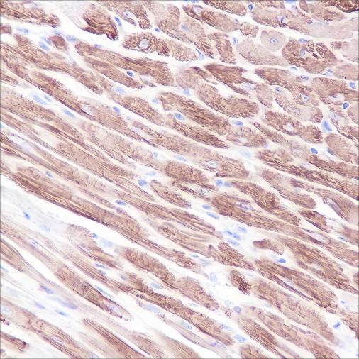 Recombinant Myosin Light Chain 3 Monoclonal Antibody - small - 3