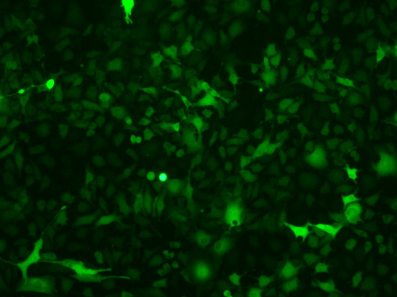 B16-F10-GFP Cell Complete Medium-searchlist-1