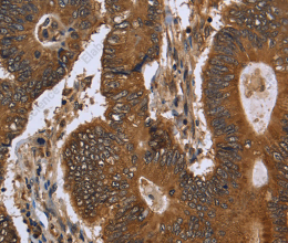 FGFRL1 Polyclonal Antibody - 2