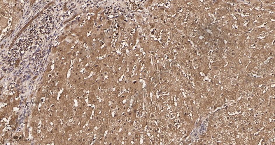 Recombinant Lactate Dehydrogenase Monoclonal Antibody - 2