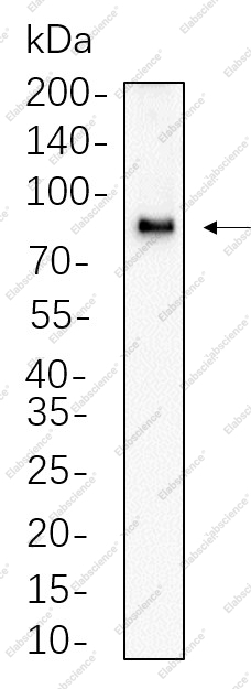 Recombinant CPT1A Monoclonal Antibody - 1