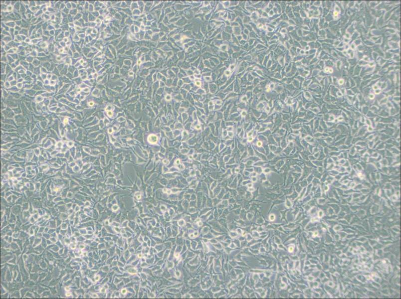 NCI-H3122 Cell Complete Medium - 2