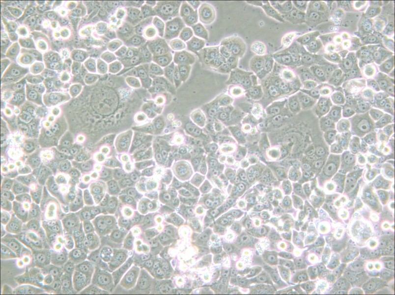 NCI-H2126 Cell Complete Medium - small - 5