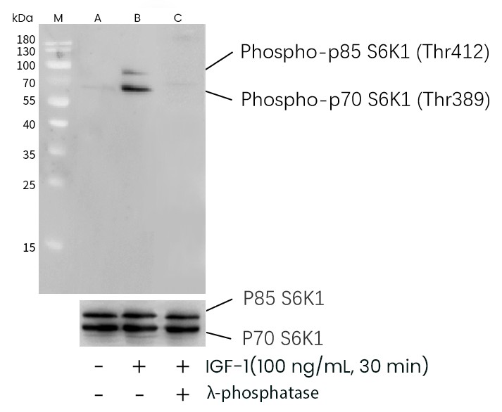 Recombinant Phospho-p70 S6 Kinase 1 (Thr389) Monoclonal Antibody-searchlist-1