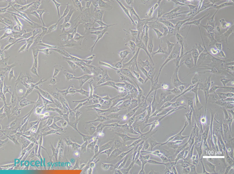 Human Dermal Papilla (Primary cell immortalization) Cell Complete Medium - 1