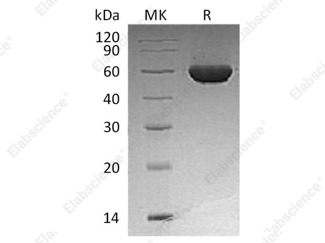 Recombinant Human ALDH1A2 Protein (His Tag) - 1