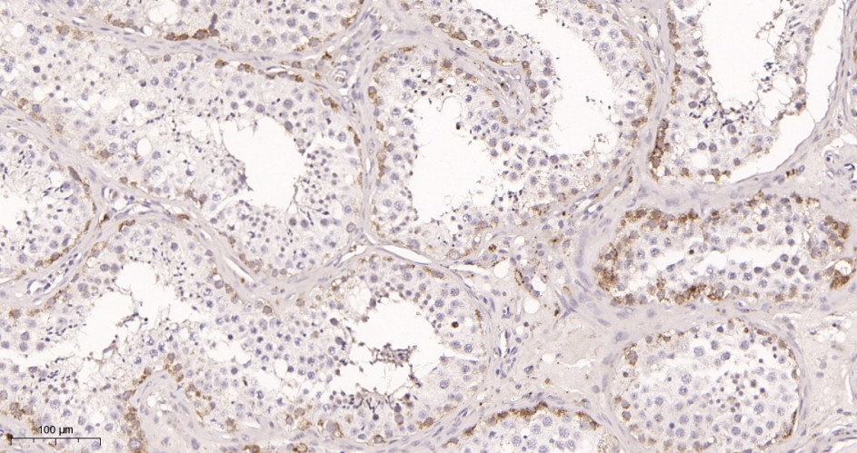 Recombinant Hsp90 Monoclonal Antibody - small - 2
