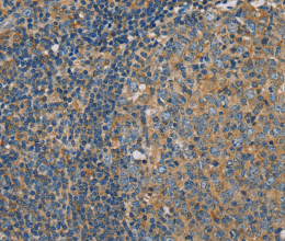 CLIC1 Polyclonal Antibody - 2