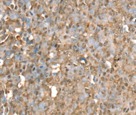 RBM5 Polyclonal Antibody - 2