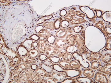 Recombinant ALY Monoclonal Antibody - 1