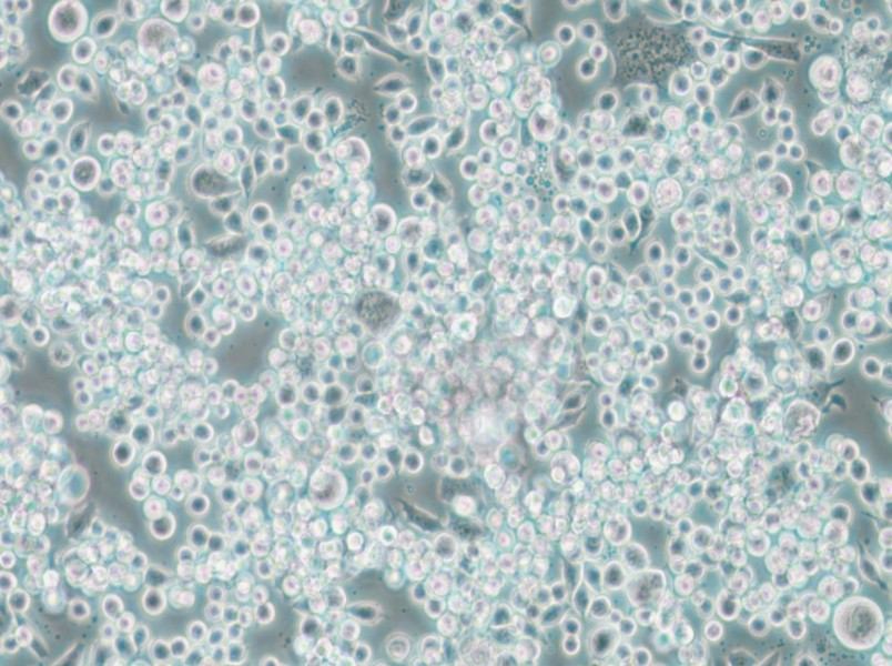 Lu-65 Cell Complete Medium - 5