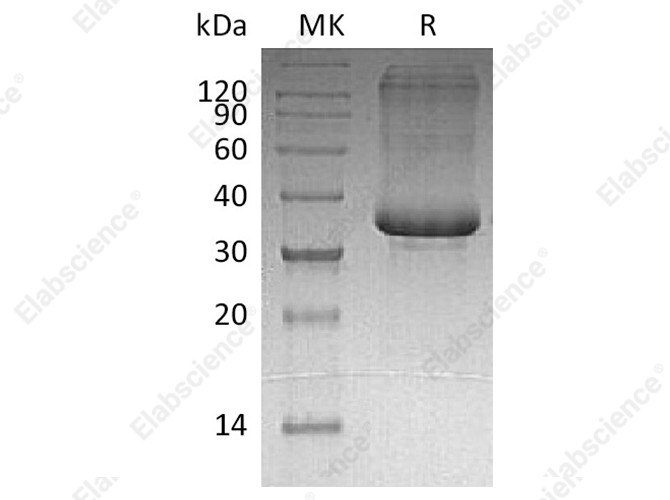 Recombinant Human SP-10/ACRV1 Protein (His Tag) - 1