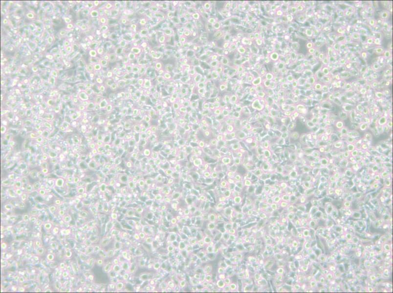 MM.1S Cell Complete Medium-searchlist-1