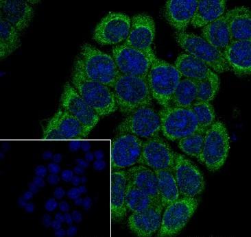 Recombinant ALDH7A1 Monoclonal Antibody - small - 7