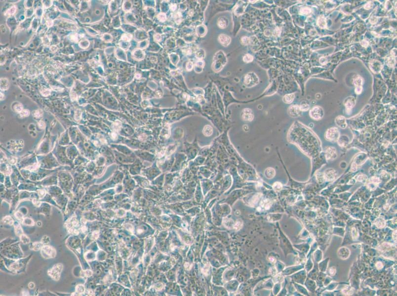 SNU-398 Cell Complete Medium - small - 12