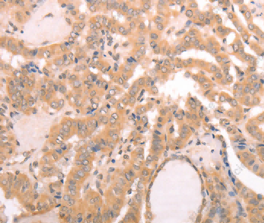 AASDHPPT Polyclonal Antibody - 2