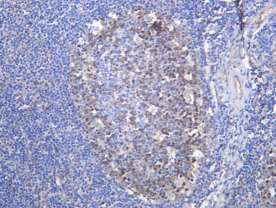 Recombinant Thymidine Kinase Monoclonal Antibody - 2