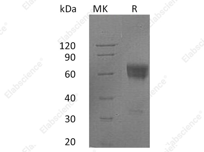 Recombinant Human FAS/TNFRSF6 Protein (Fc Tag) - 1