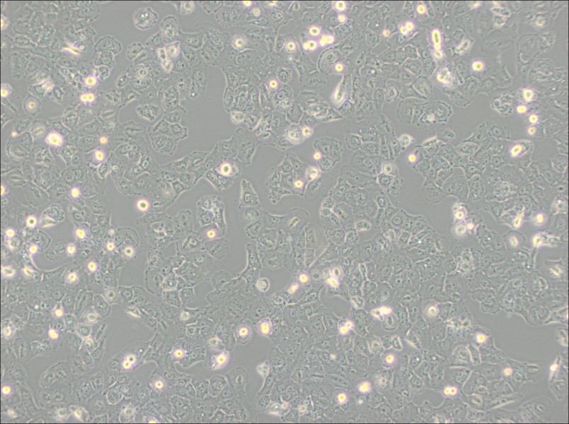 Caov-3 Cell Complete Medium - 3
