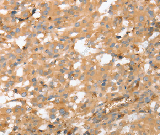 AHSG Polyclonal Antibody - 2