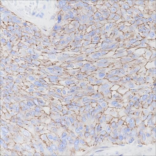Recombinant CD138/Syndecan-1 Monoclonal Antibody - small - 2