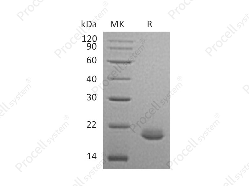 FGF-10/FGFA/KGF2, Human, Recombinant