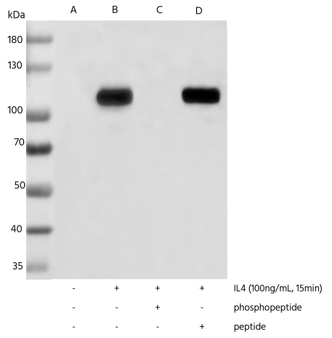 Recombinant Phospho-Stat6 (Tyr641) Monoclonal Antibody - small - 4