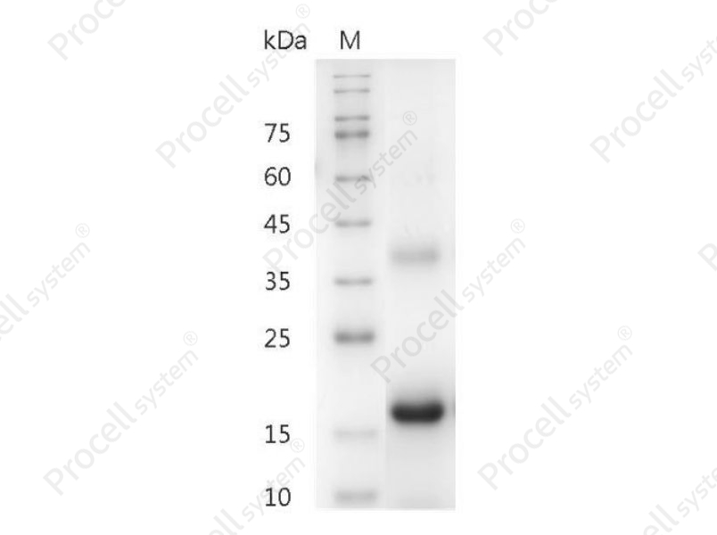 M-CSF/CSF-1/MGI-IM, Mouse, Recombinant