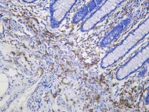 Recombinant Myelin Protein Zero Monoclonal Antibody - 1