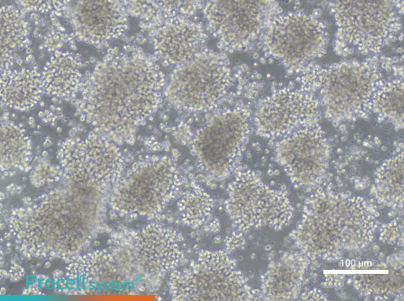 WSU-NHL Cell Complete Medium - 1