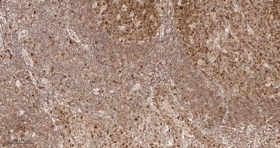 Recombinant CDK2 Monoclonal Antibody - 2