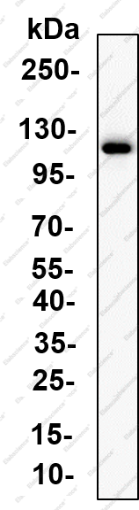 Recombinant NAT10 Monoclonal Antibody - 2