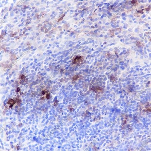 Recombinant B7-H3/CD276 Monoclonal Antibody - 5