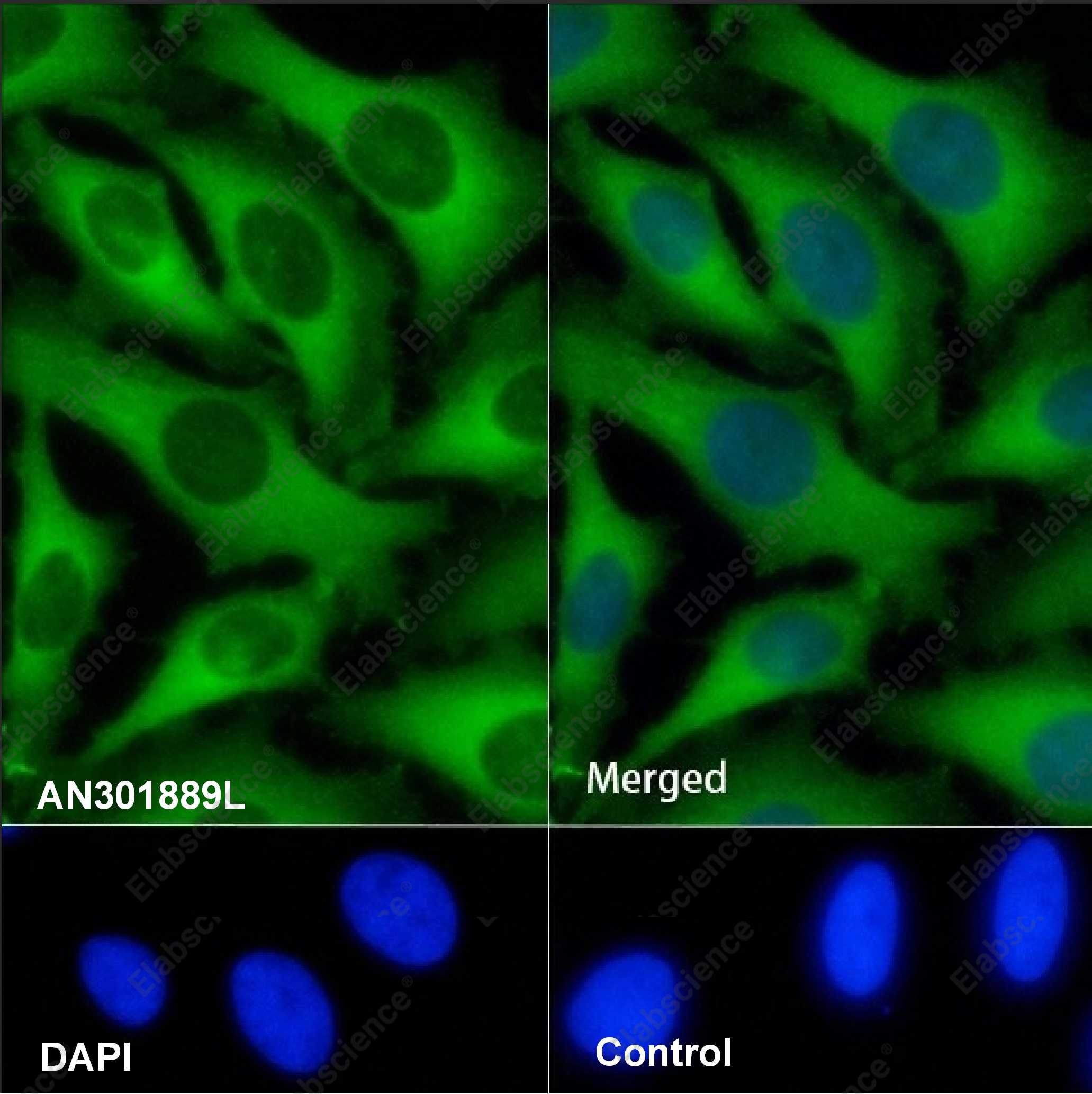 Recombinant KIF5B Monoclonal Antibody - 5